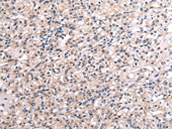 兔抗RNF115多克隆抗体