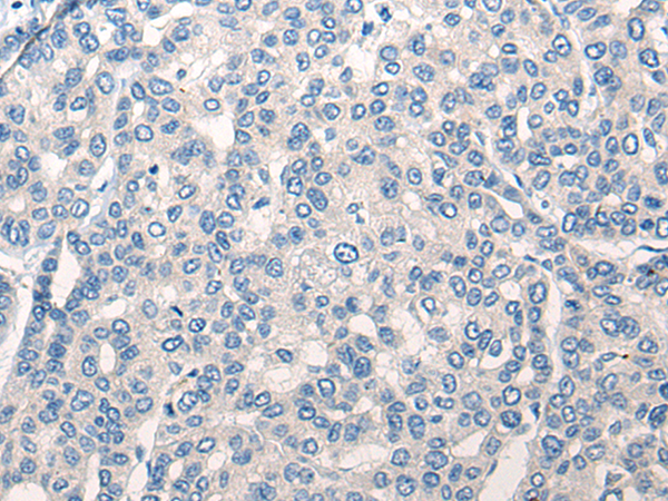 兔抗RNF138多克隆抗体