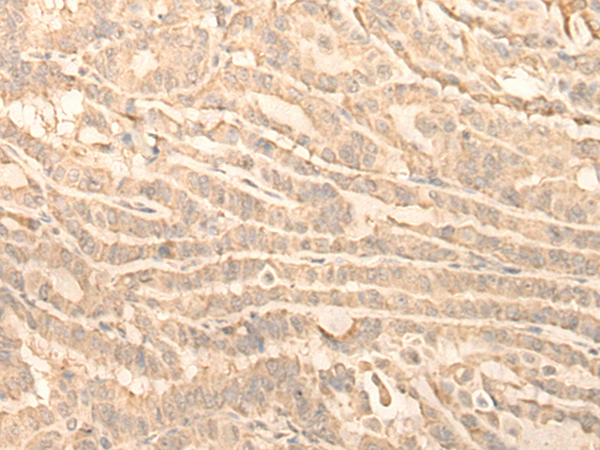 兔抗RNF146多克隆抗体