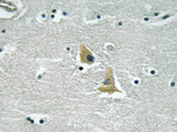 兔抗NCF1(Ab-345)多克隆抗体 