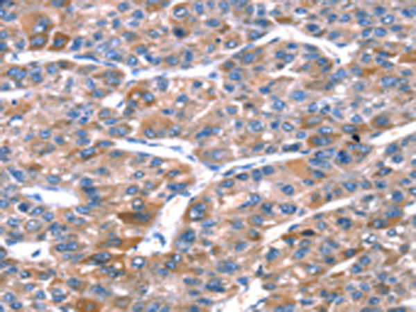 兔抗RPL11多克隆抗体