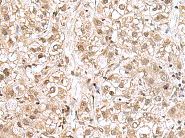 兔抗RPL35多克隆抗体