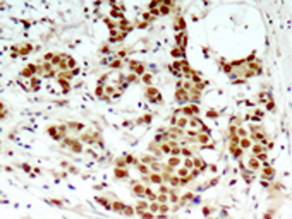 兔抗RPS6KA1 (Phospho-Thr348)多克隆抗体