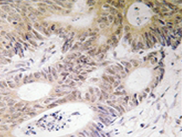 兔抗RPS6KA5(Ab-212) 多克隆抗体