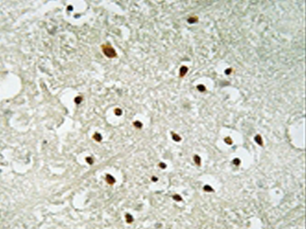 兔抗RPS19BP1多克隆抗体