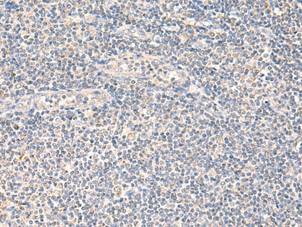 兔抗NEGR1多克隆抗体