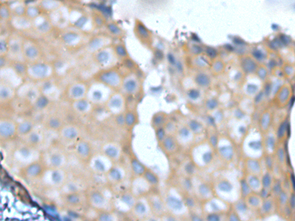 兔抗NF1多克隆抗体