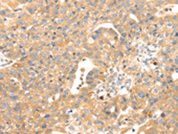 兔抗S100A12多克隆抗体