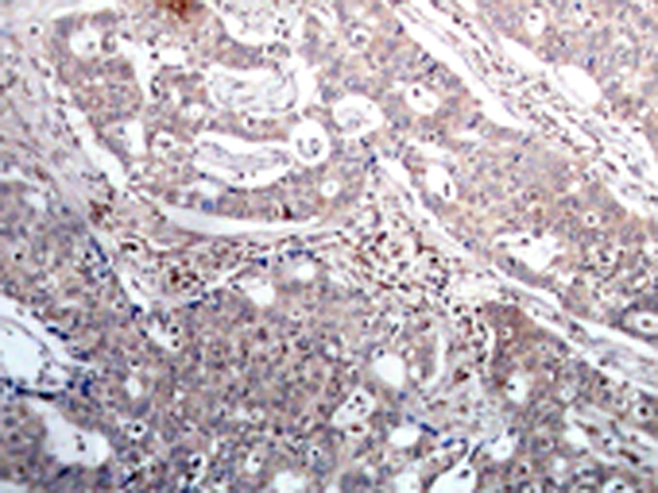 兔抗NFKBIB (Phospho-Ser23)多克隆抗体