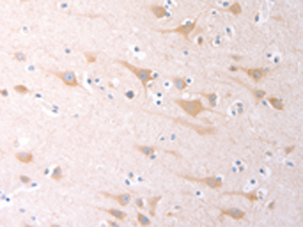 兔抗SCGB1A1多克隆抗体
