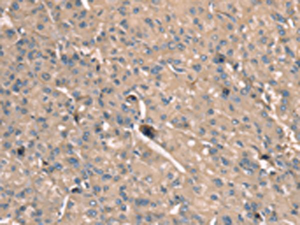 兔抗SCN1B多克隆抗体