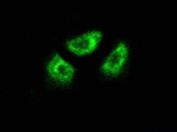 兔抗SCN7A多克隆抗体