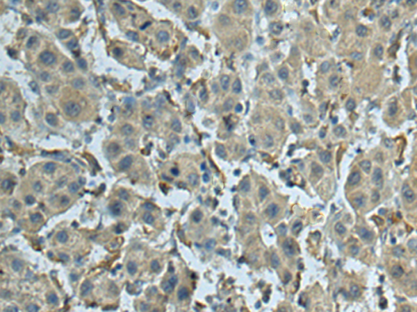 兔抗SCNM1多克隆抗体