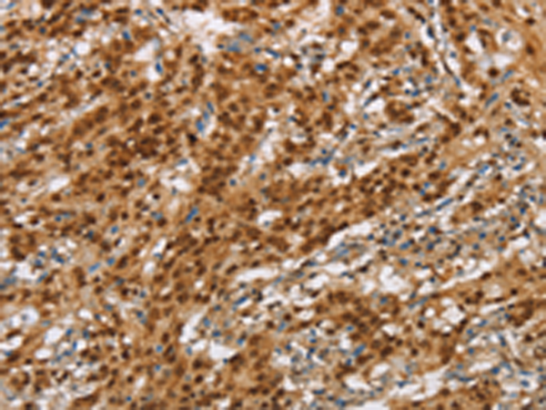兔抗NLRP7多克隆抗体