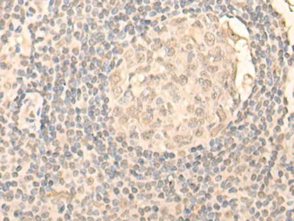 兔抗NOLC1多克隆抗体