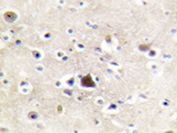 兔抗NR3C1(Ab-226)多克隆抗体
