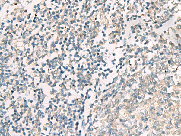 兔抗SERPINB4多克隆抗体