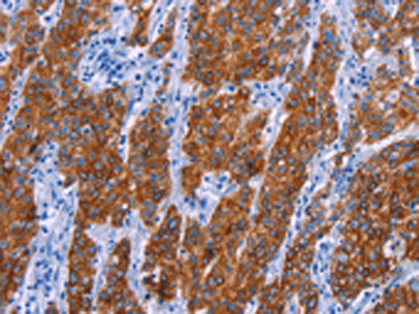 兔抗NR4A2多克隆抗体