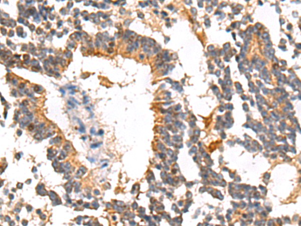 兔抗SERPINB7多克隆抗体