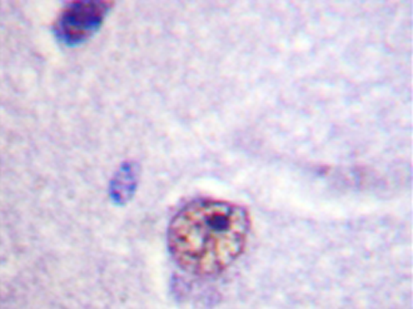 兔抗SF1(Ab-82) 多克隆抗体