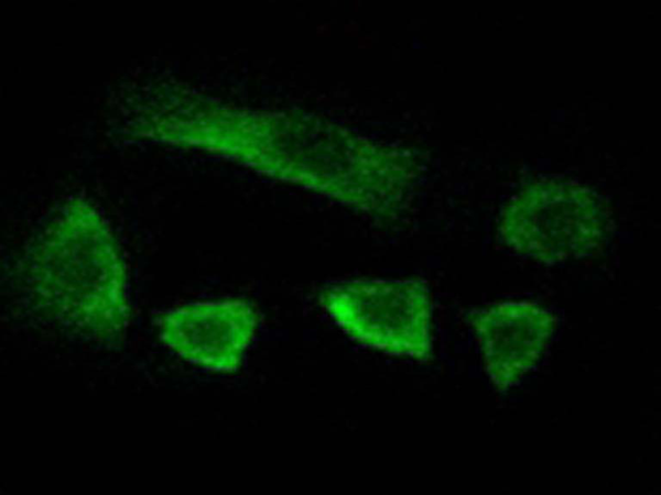 兔抗NT5C1B多克隆抗体