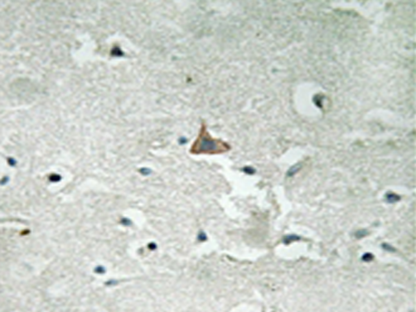 兔抗NTRK2(Phospho-Tyr706Tyr707)多克隆抗体