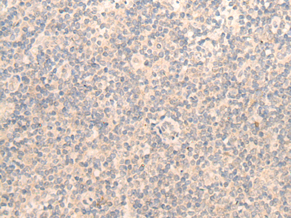 兔抗OLFML3多克隆抗体