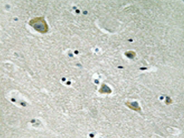 兔抗PAK1(Phospho-Ser204)多克隆抗体