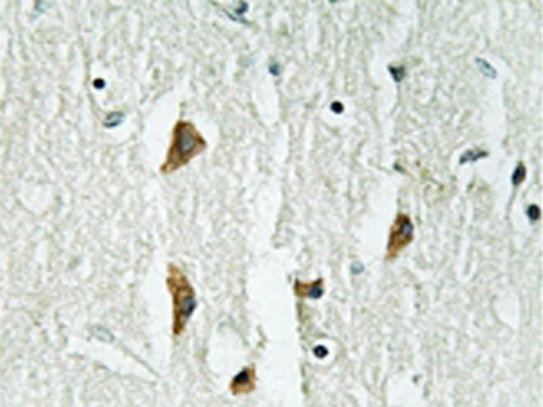 兔抗PAK123(Ab-423402421)多克隆抗体