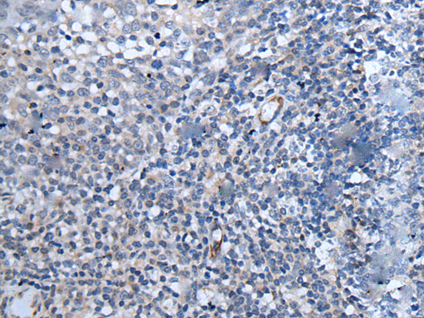 兔抗PAPPA-AS1多克隆抗体