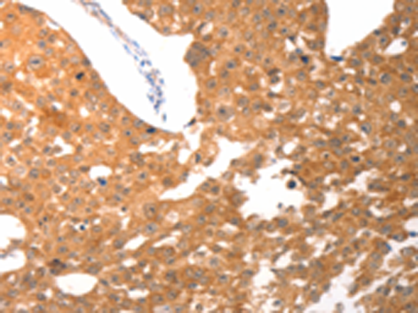 兔抗PARP1(cleaved)多克隆抗体