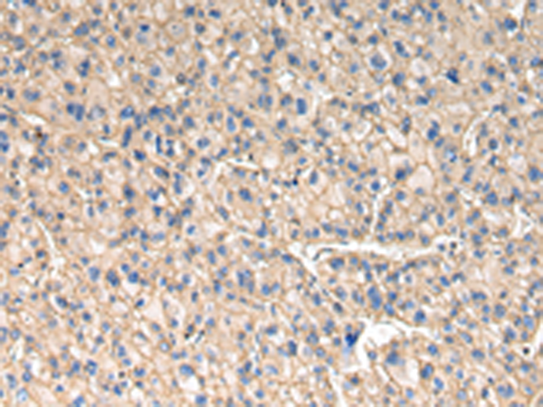 兔抗SLC1A1多克隆抗体