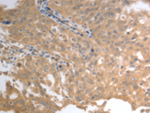 兔抗SLC1A4多克隆抗体