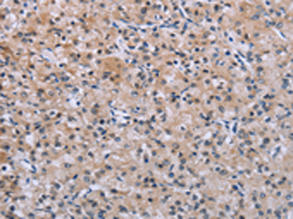 兔抗SLC1A6多克隆抗体 