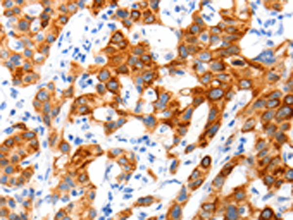 兔抗SLC2A11多克隆抗体