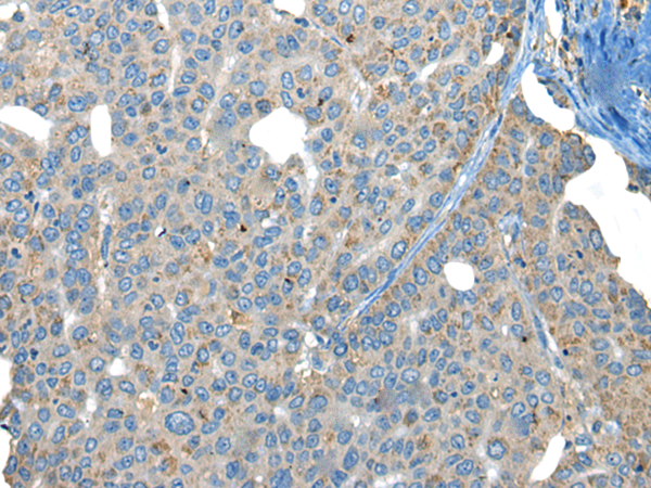 兔抗SLC3A2多克隆抗体