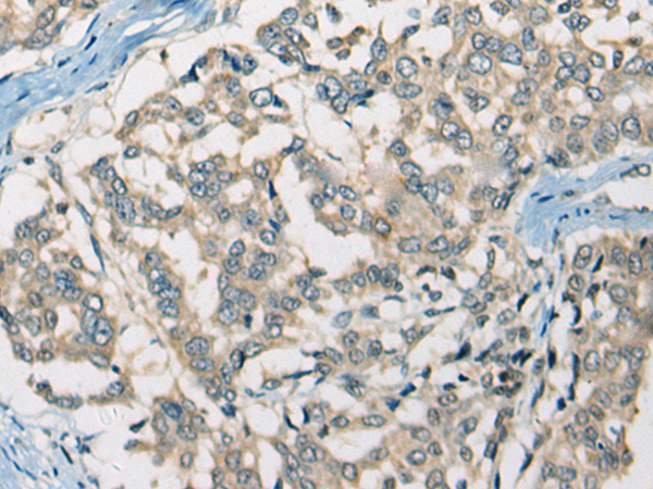 兔抗SLC5A3 多克隆抗体
