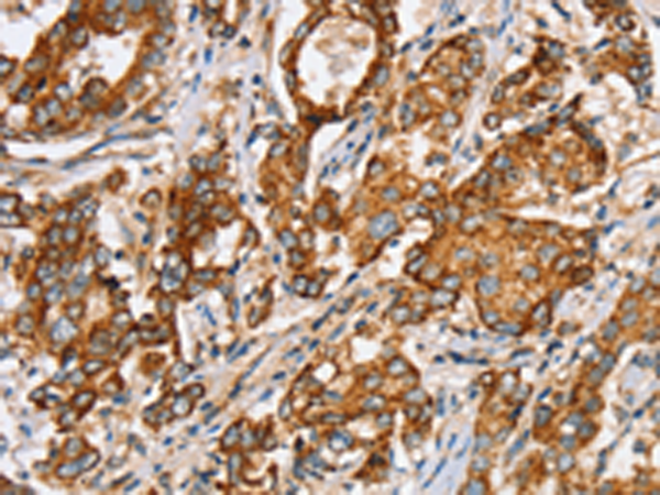 兔抗SLC5A11多克隆抗体