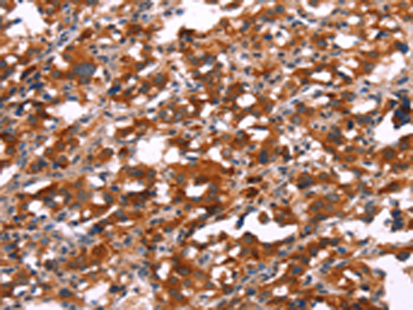 兔抗SLC6A1多克隆抗体