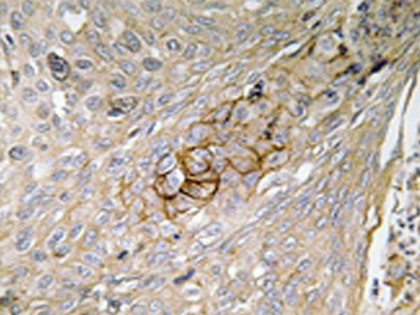 兔抗SLC6A6多克隆抗体