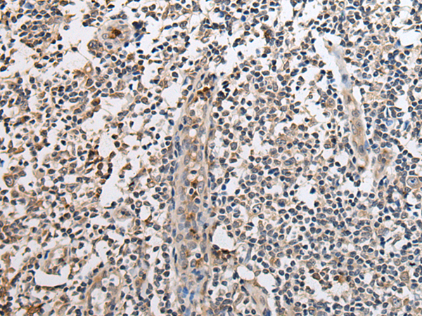 兔抗SLC8A1多克隆抗体