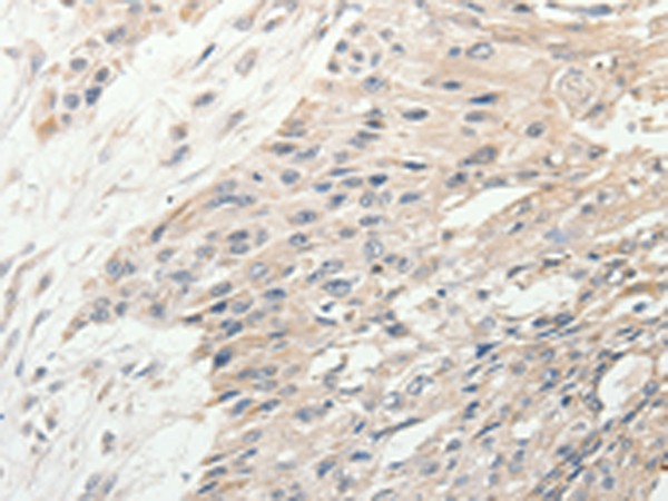 兔抗SLC9A7多克隆抗体