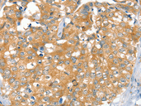 兔抗SLC9A9多克隆抗体