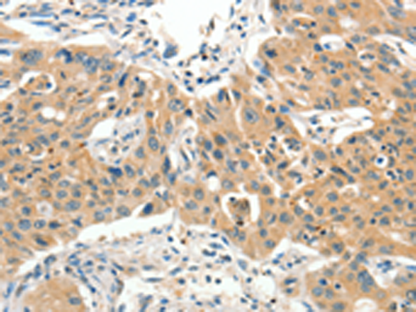 兔抗SLC11A2多克隆抗体