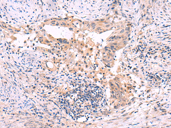兔抗SLC12A5多克隆抗体