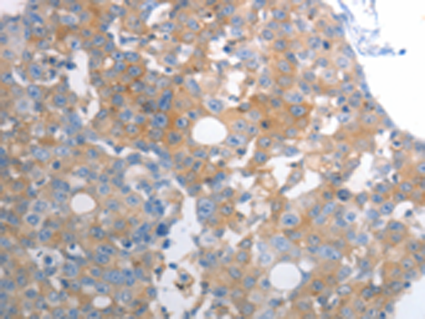 兔抗SLC12A6多克隆抗体