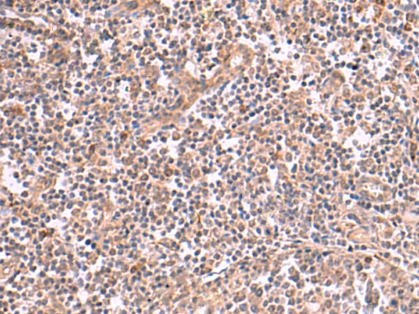 兔抗SLC12A7多克隆抗体