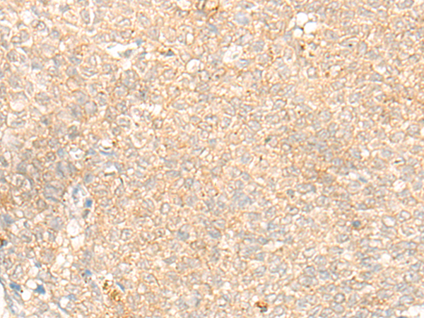 兔抗SLC15A1多克隆抗体