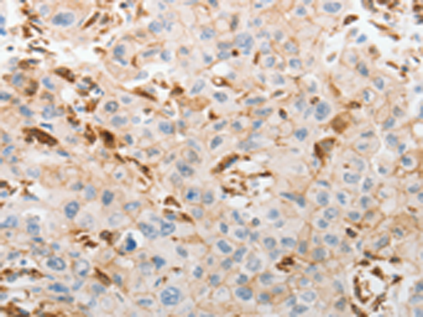 兔抗SLC15A2多克隆抗体