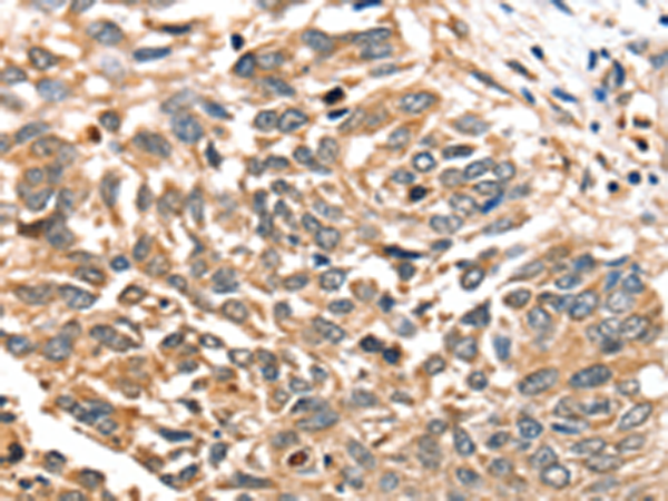 兔抗SLC16A12多克隆抗体